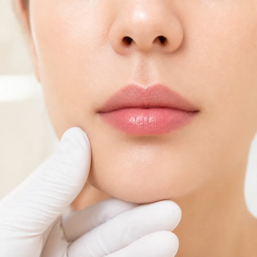 โปรแกรม Upper Lip Lift